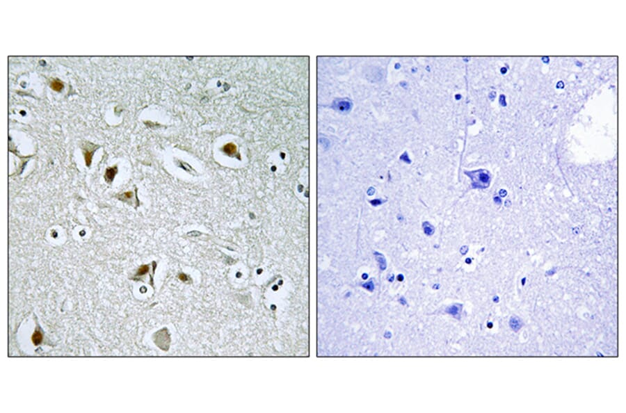 Immunohistochemistry - Anti-CDKA2 Antibody (C10199) - Antibodies.com