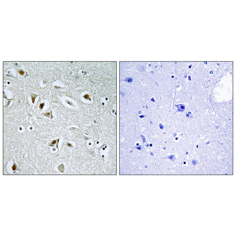 Immunohistochemistry - Anti-CDKA2 Antibody (C10199) - Antibodies.com