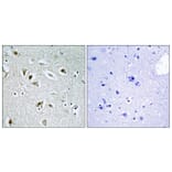 Immunohistochemistry - Anti-CDKA2 Antibody (C10199) - Antibodies.com