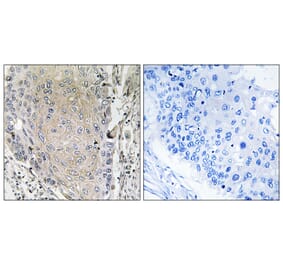 Immunohistochemistry - Anti-CBLN3 Antibody (C15058) - Antibodies.com