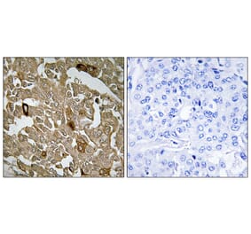 Immunohistochemistry - Anti-BTBD6 Antibody (C11508) - Antibodies.com