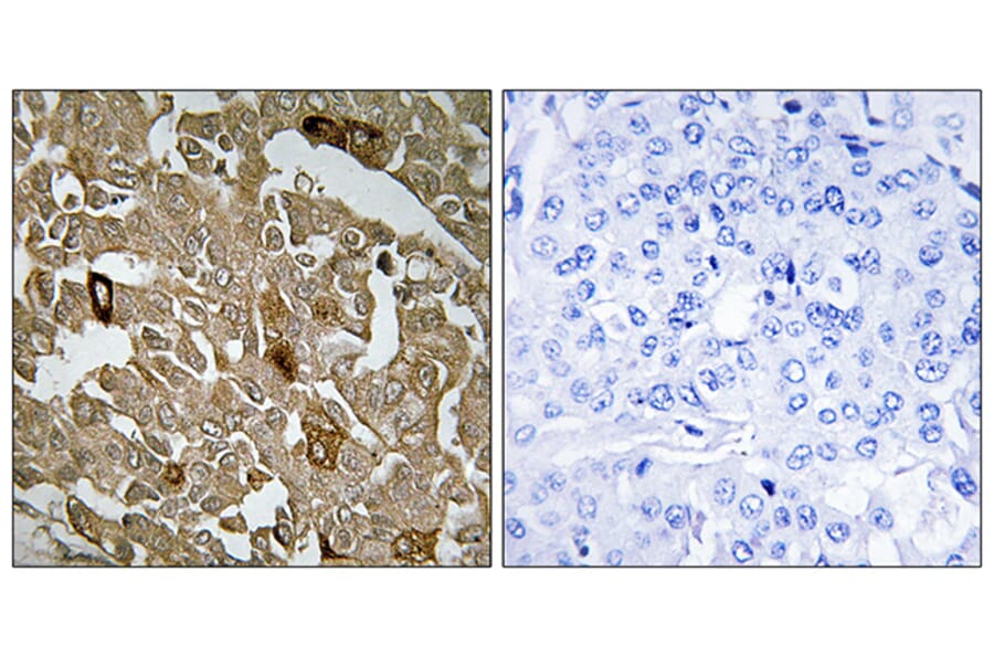 Immunohistochemistry - Anti-BTBD6 Antibody (C11508) - Antibodies.com