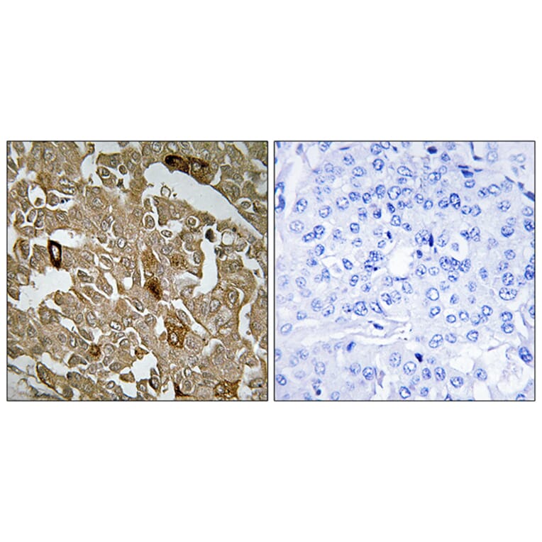Immunohistochemistry - Anti-BTBD6 Antibody (C11508) - Antibodies.com
