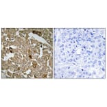 Immunohistochemistry - Anti-BTBD6 Antibody (C11508) - Antibodies.com