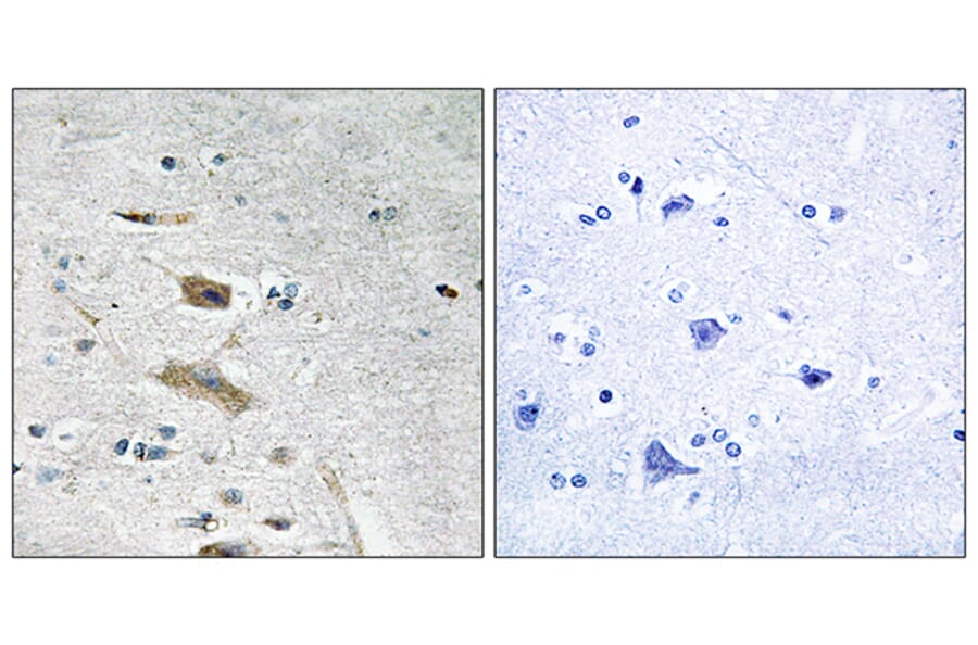 Immunohistochemistry - Anti-ABHD4 Antibody (C14216) - Antibodies.com