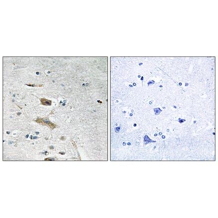 Immunohistochemistry - Anti-ABHD4 Antibody (C14216) - Antibodies.com