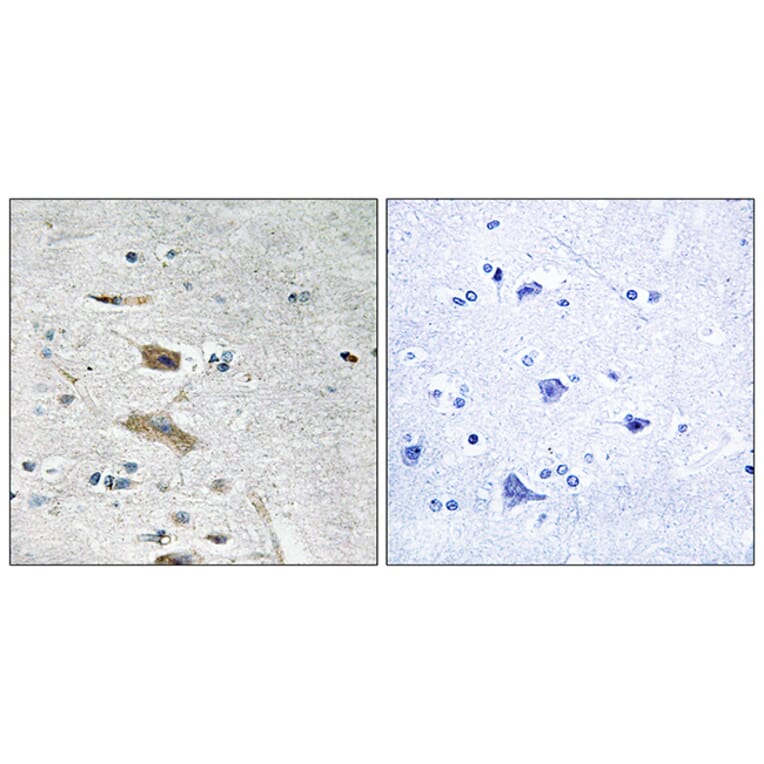 Immunohistochemistry - Anti-ABHD4 Antibody (C14216) - Antibodies.com