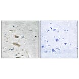 Immunohistochemistry - Anti-ABHD4 Antibody (C14216) - Antibodies.com