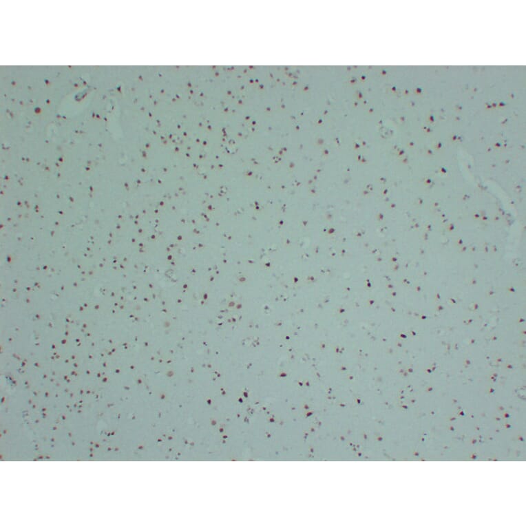 Immunohistochemistry - Anti-INI 1 Antibody (V0086) - Antibodies.com
