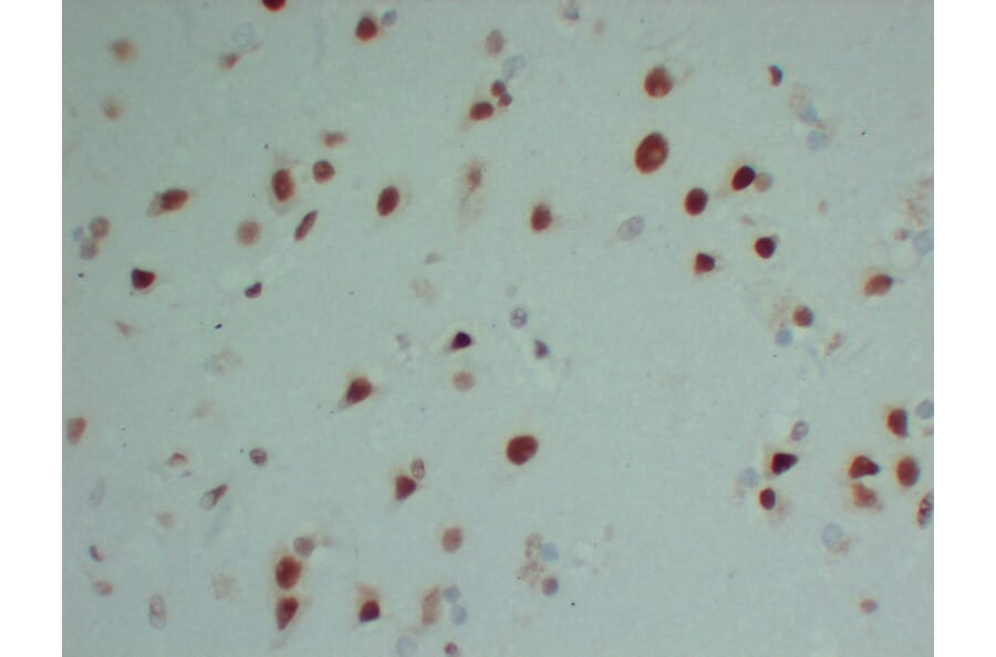Immunohistochemistry - Anti-INI 1 Antibody (V0086) - Antibodies.com