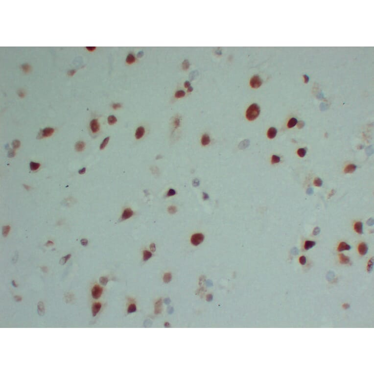 Immunohistochemistry - Anti-INI 1 Antibody (V0086) - Antibodies.com