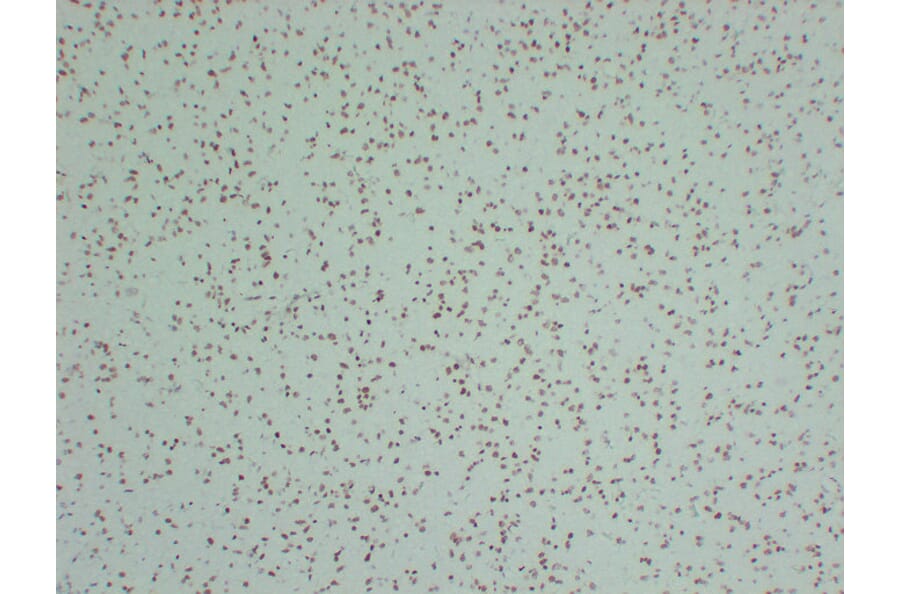 Immunohistochemistry - Anti-INI 1 Antibody (V0086) - Antibodies.com