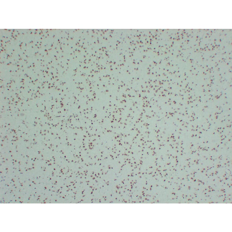 Immunohistochemistry - Anti-INI 1 Antibody (V0086) - Antibodies.com