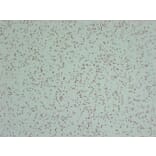 Immunohistochemistry - Anti-INI 1 Antibody (V0086) - Antibodies.com