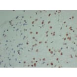 Immunohistochemistry - Anti-INI 1 Antibody (V0086) - Antibodies.com