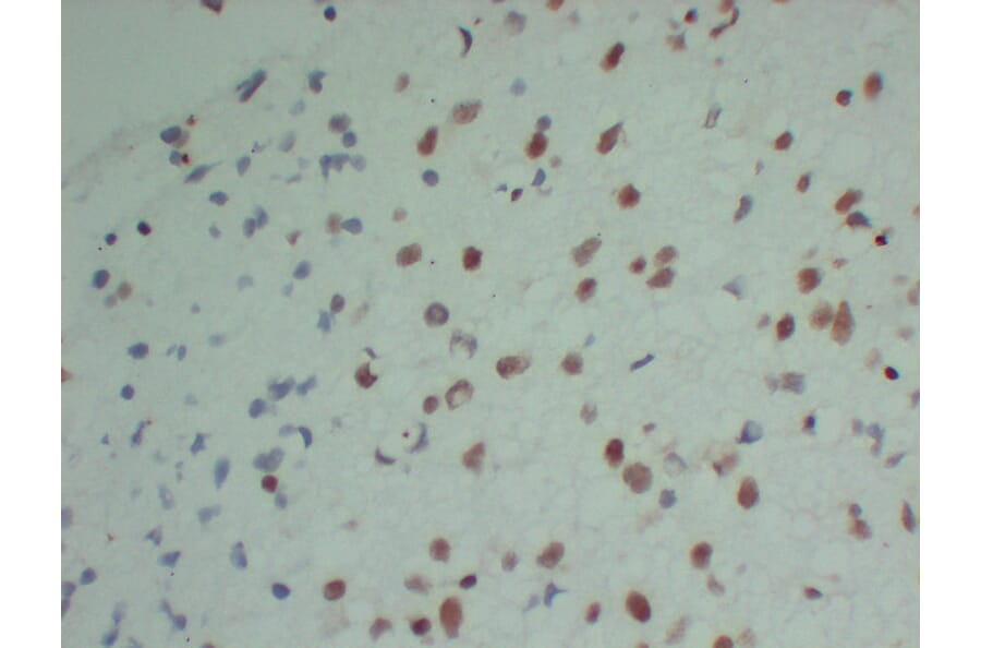 Immunohistochemistry - Anti-INI 1 Antibody (V0086) - Antibodies.com