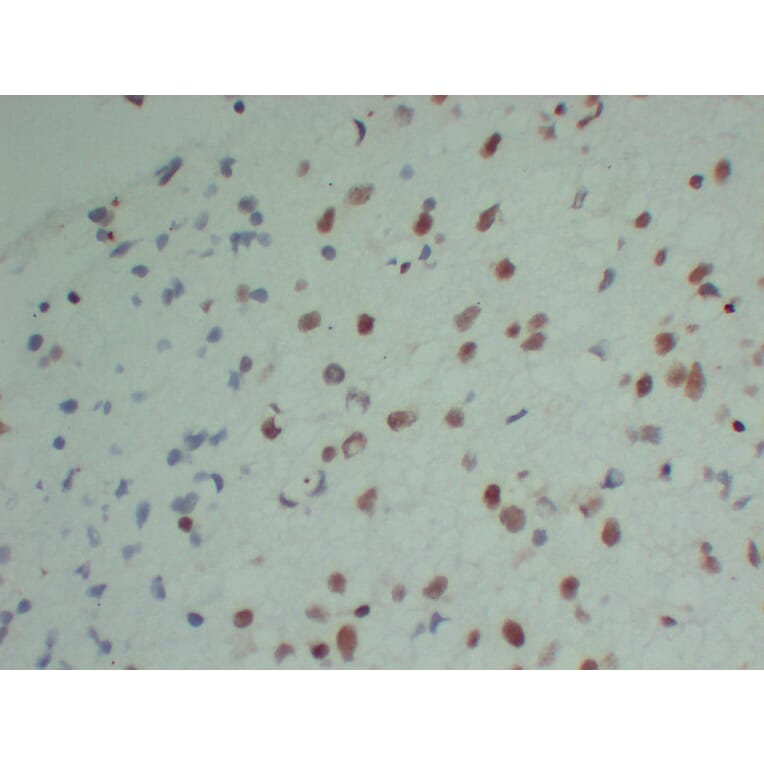 Immunohistochemistry - Anti-INI 1 Antibody (V0086) - Antibodies.com