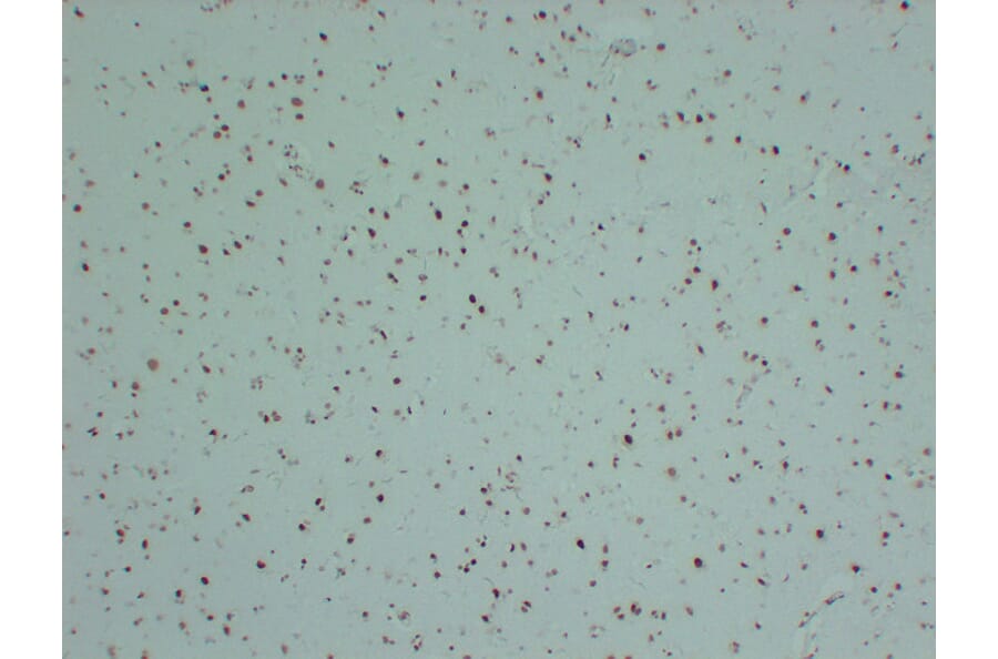 Immunohistochemistry - Anti-INI 1 Antibody (V0086) - Antibodies.com