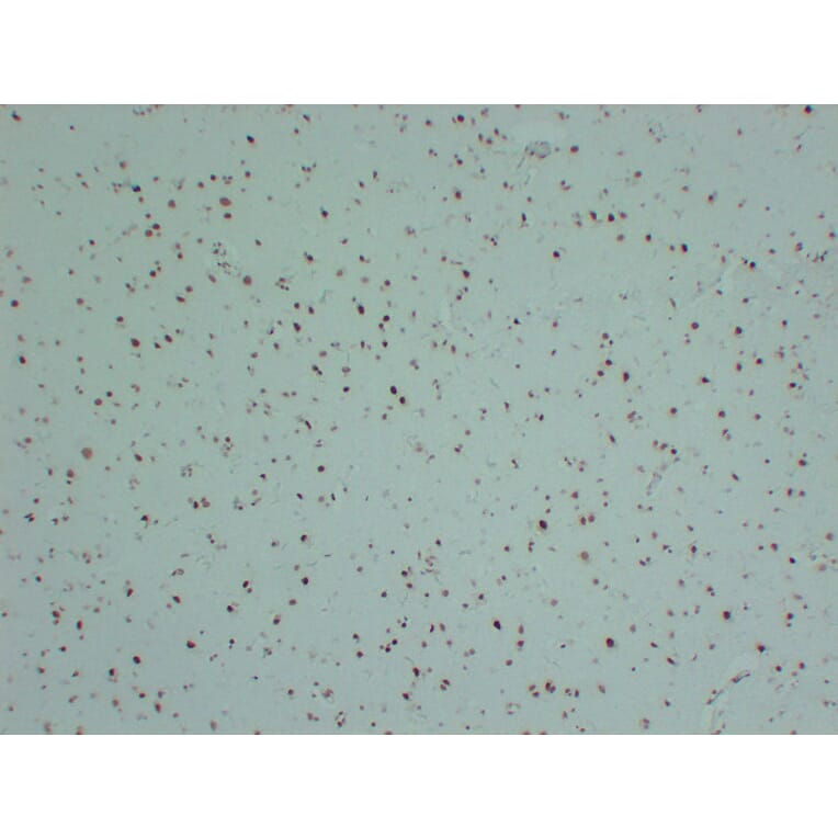 Immunohistochemistry - Anti-INI 1 Antibody (V0086) - Antibodies.com