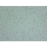 Immunohistochemistry - Anti-INI 1 Antibody (V0086) - Antibodies.com
