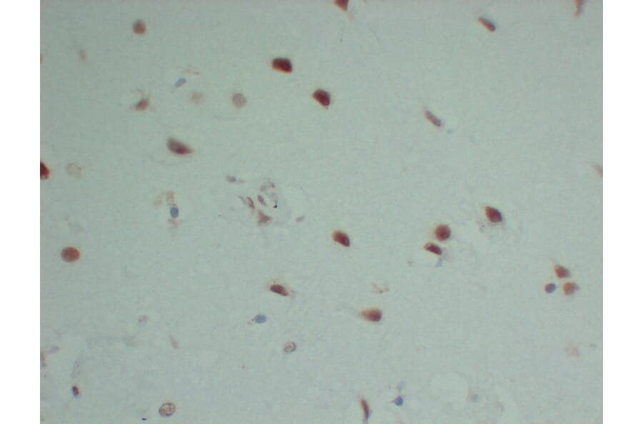 Immunohistochemistry - Anti-INI 1 Antibody (V0086) - Antibodies.com