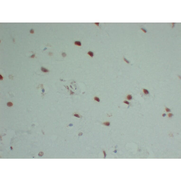 Immunohistochemistry - Anti-INI 1 Antibody (V0086) - Antibodies.com