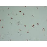 Immunohistochemistry - Anti-INI 1 Antibody (V0086) - Antibodies.com