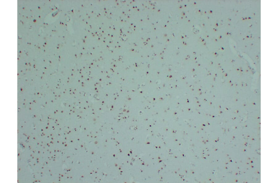 Immunohistochemistry - Anti-INI 1 Antibody (V0086) - Antibodies.com