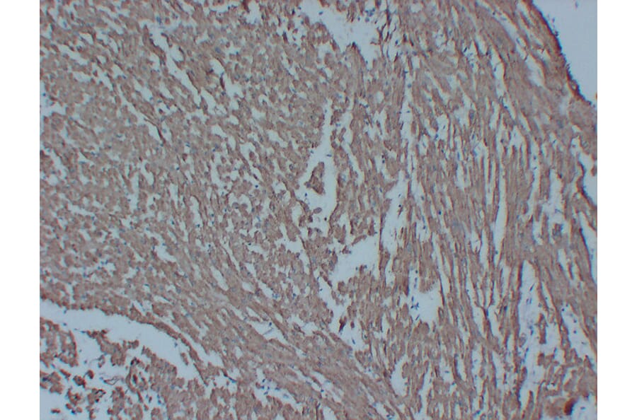 Immunohistochemistry - Anti-Actin Antibody (V0005) - Antibodies.com