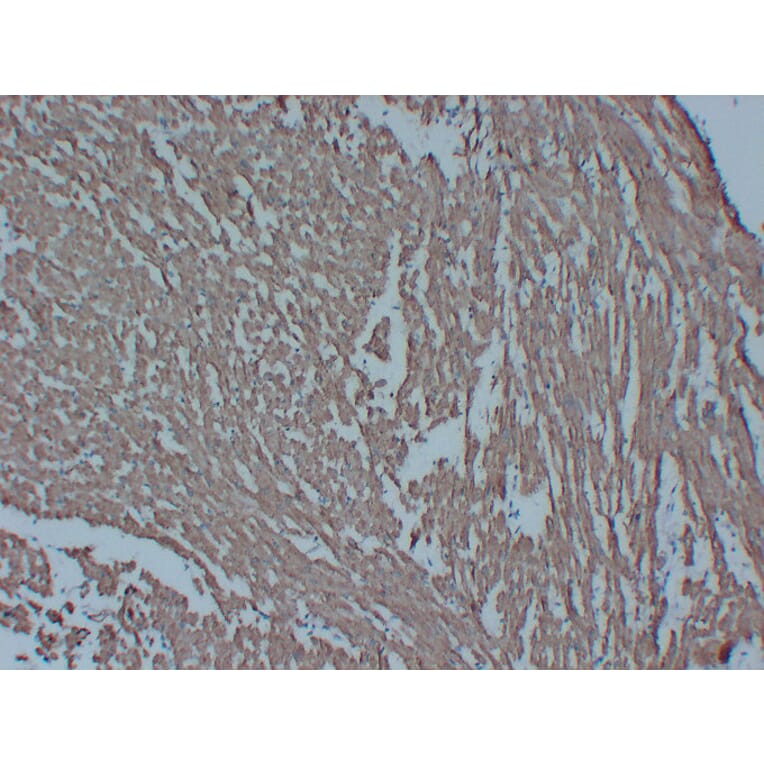 Immunohistochemistry - Anti-Actin Antibody (V0005) - Antibodies.com