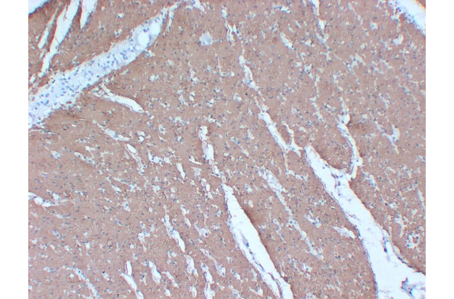 Immunohistochemistry - Anti-Actin Antibody (V0005) - Antibodies.com