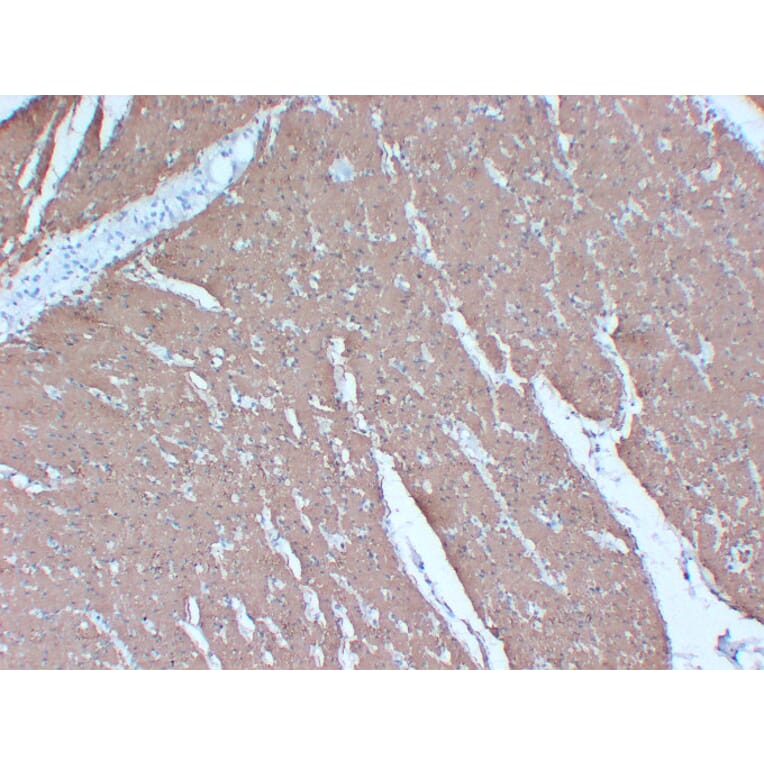 Immunohistochemistry - Anti-Actin Antibody (V0005) - Antibodies.com