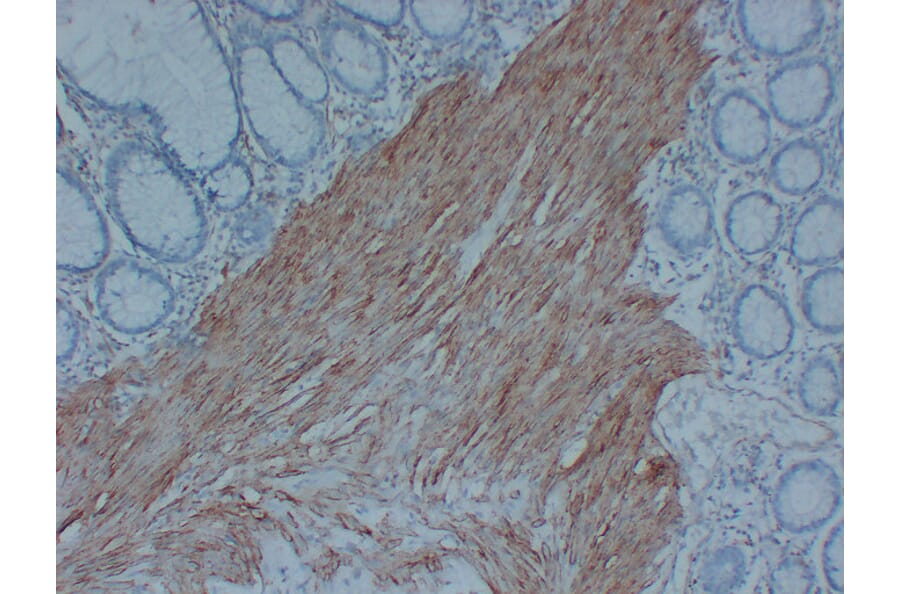Immunohistochemistry - Anti-Actin Antibody (V0005) - Antibodies.com