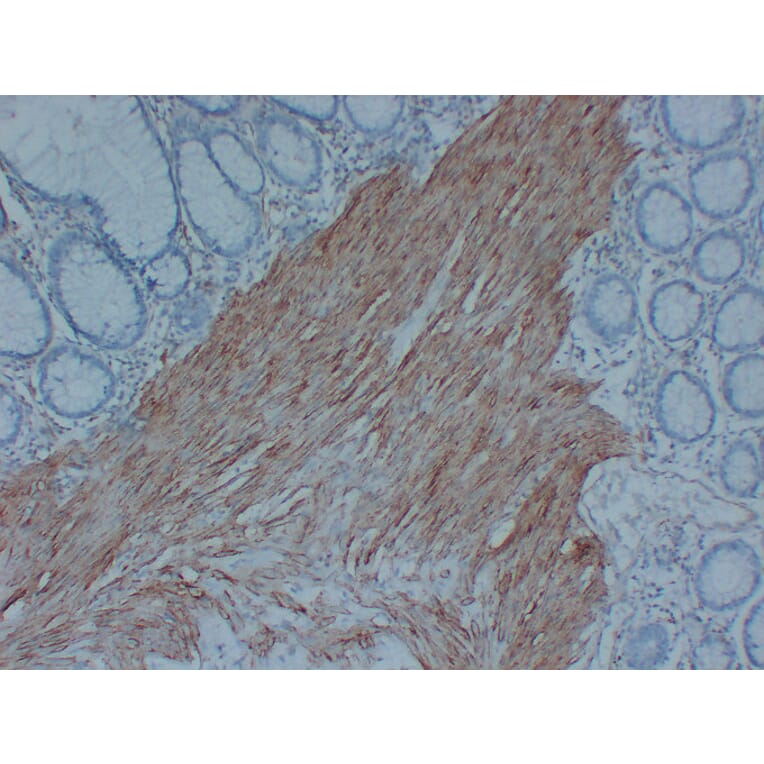 Immunohistochemistry - Anti-Actin Antibody (V0005) - Antibodies.com