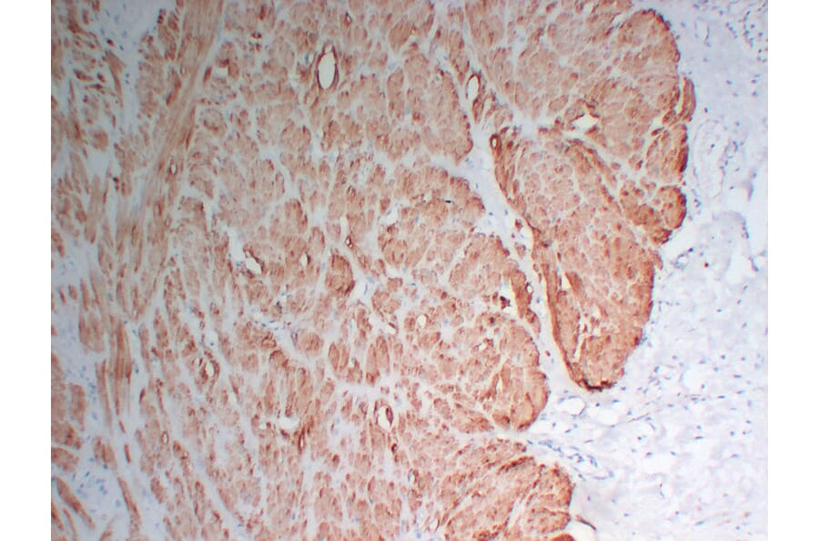 Immunohistochemistry - Anti-Actin Antibody (V0005) - Antibodies.com