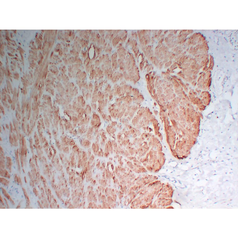 Immunohistochemistry - Anti-Actin Antibody (V0005) - Antibodies.com