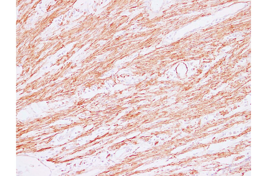 Immunohistochemistry - Anti-Actin Antibody (V0005) - Antibodies.com