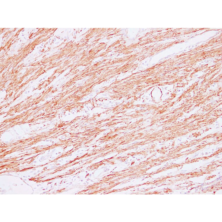 Immunohistochemistry - Anti-Actin Antibody (V0005) - Antibodies.com