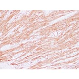 Immunohistochemistry - Anti-Actin Antibody (V0005) - Antibodies.com