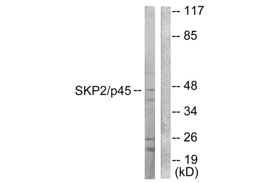 Western Blot - Anti-SKP2 Antibody (C0324) - Antibodies.com
