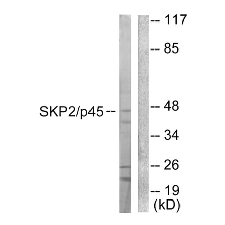 Western Blot - Anti-SKP2 Antibody (C0324) - Antibodies.com