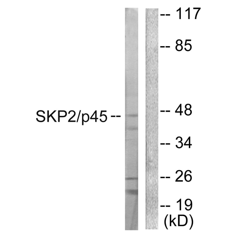 Western Blot - Anti-SKP2 Antibody (C0324) - Antibodies.com