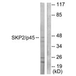 Western Blot - Anti-SKP2 Antibody (C0324) - Antibodies.com