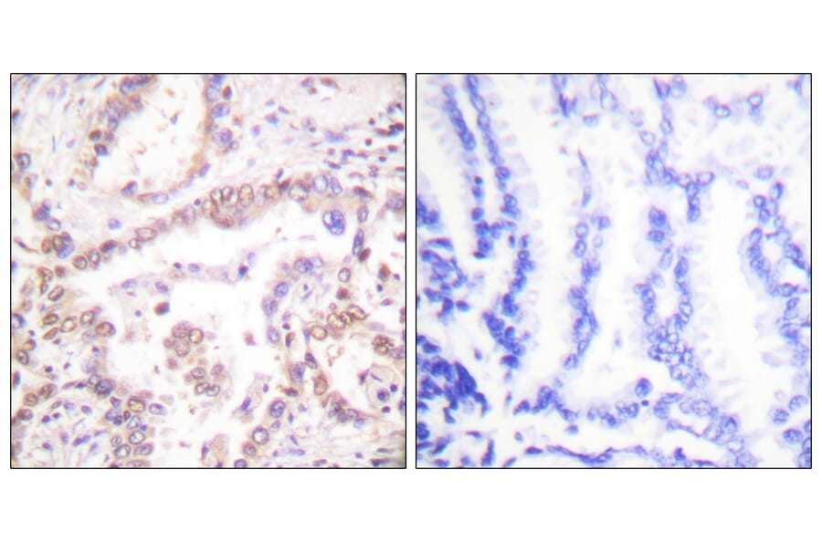 Immunohistochemistry - Anti-SKP2 Antibody (C0324) - Antibodies.com