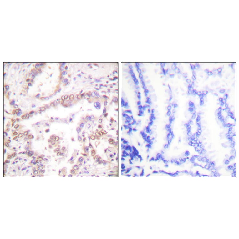 Immunohistochemistry - Anti-SKP2 Antibody (C0324) - Antibodies.com