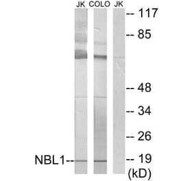 Western Blot - Anti-NBL1 Antibody (C10599) - Antibodies.com