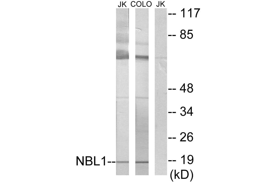 Western Blot - Anti-NBL1 Antibody (C10599) - Antibodies.com