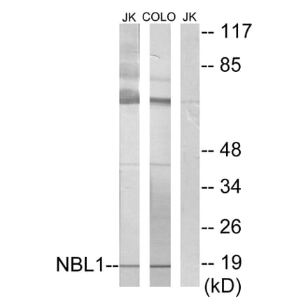 Western Blot - Anti-NBL1 Antibody (C10599) - Antibodies.com
