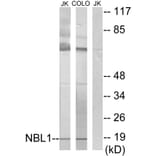 Western Blot - Anti-NBL1 Antibody (C10599) - Antibodies.com