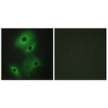 Immunofluorescence - Anti-NBL1 Antibody (C10599) - Antibodies.com